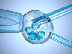 (a)代孕价格低,杭州供卵试管供卵试管试管婴儿助孕机构对精子DNA碎片的详细解