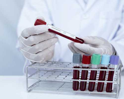 南昌代孕最好的中心|试管婴儿想做就做？只有这些不孕症患者适合试管婴儿_南