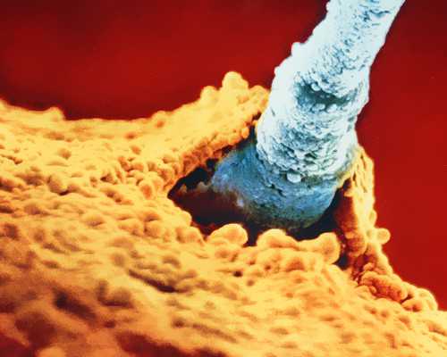 试管婴儿需不需要检查性激素六项(为什么不孕要检查性激素六项)