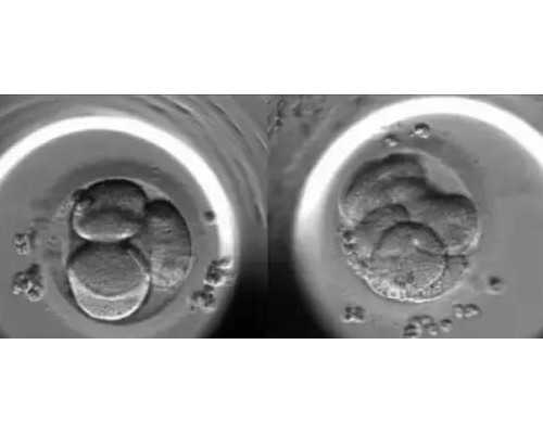 AA69实验室在哪_aa69公司怎样,第三代试管婴儿成功率咨询-深圳有供卵的私立医院