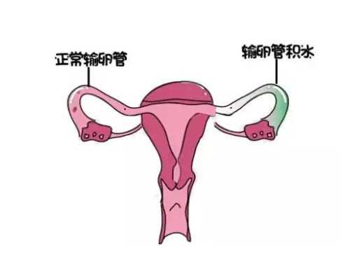 南昌试管代怀花销|南昌三代试管包生男孩包成功价格多少20万够不够