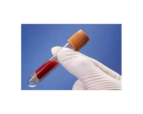 女宝宝内搭上衣0-1岁