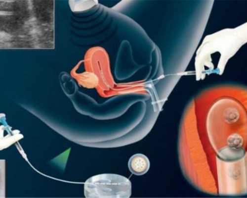 48岁代孕当妈_360化妆品网,女性不孕不育吃什么好 五类食物应常吃-西安供卵试管