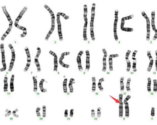 2026徐州二院不排队直接做供卵试管多少钱？