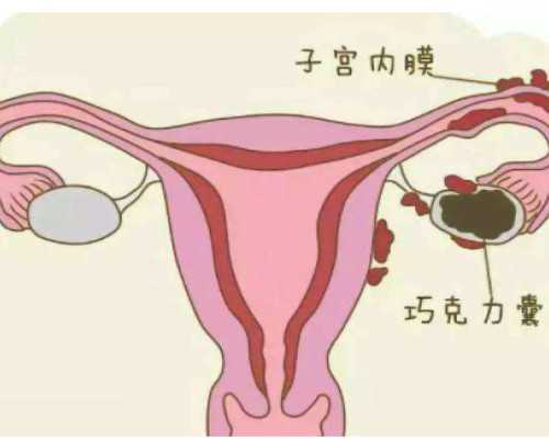 40岁肌瘤供卵自怀_专业代生,怎么区分助孕和避孕的食物_女人做输卵管小手术可