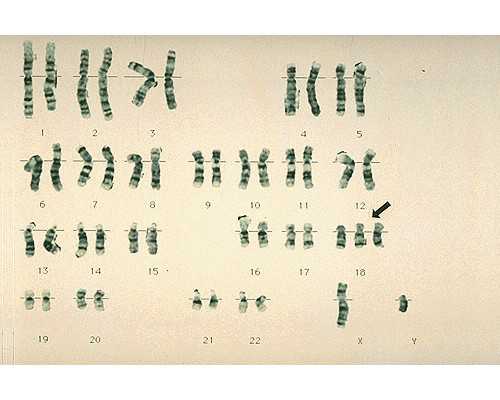 三代试管选男女_69助孕公司,做试管婴儿降调节什么意思？为什么要降调节？_上