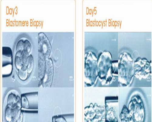 代怀产子费用_51宝贝助孕机构,泰国试管婴儿穿刺取卵，一步解决排卵障碍_湖州