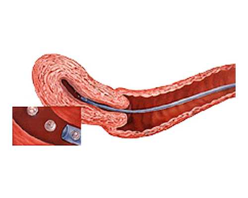 (a)代孕有成功的吗,北大人民医院试管婴儿成功率有多少？一次试管成功率高吗