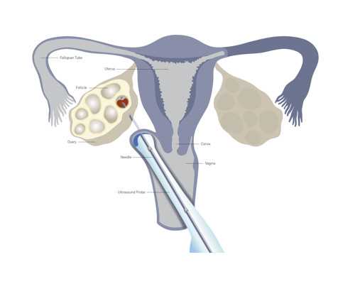 代怀最靠谱的公司_代怀小孩哪里便宜,拉拉去丹麦精子库买精子做试管婴儿可以
