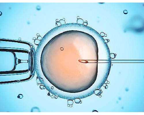 泰国试管婴儿翻译需不需要请？,包男孩代怀