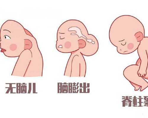 (a)代孕价格低,杭州供卵试管供卵试管试管婴儿助孕机构对精子DNA碎片的详细解