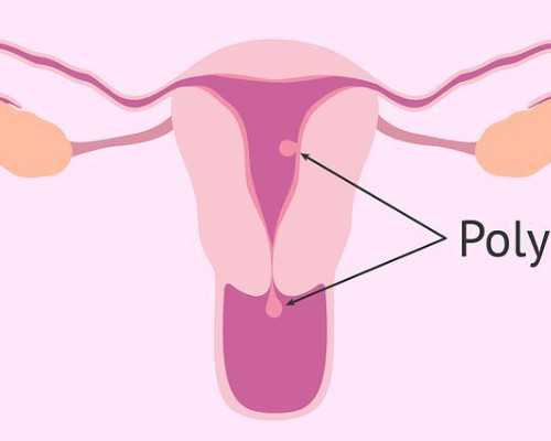 哪里代生,吉林供卵供卵代怀助孕微信（北京供卵代怀微信群）