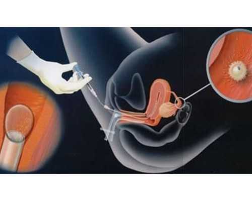 aa69官网_三代助孕试管成功率,2026
年北京市官方民间供卵试管机构统计排名前三