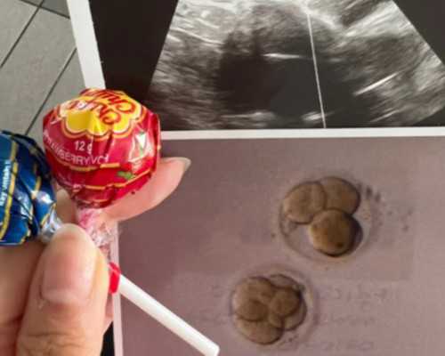 能借卵助孕吗,潍坊三代供卵代怀助孕生双胞胎费用多少钱