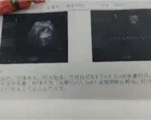 哪里助孕,做滁州助孕供卵代怀婴儿详细过程是什么的