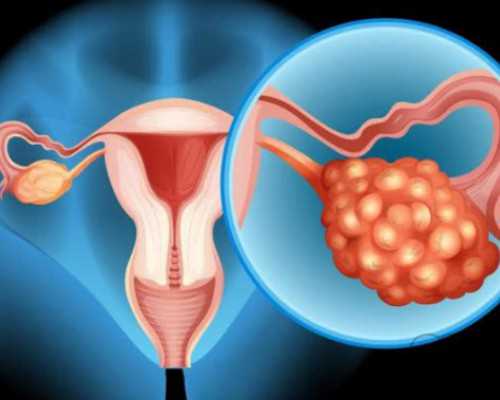 怀孕初期便秘怎么办_哪里有育儿师培训,怀孕前的准备：孕前检查9大项