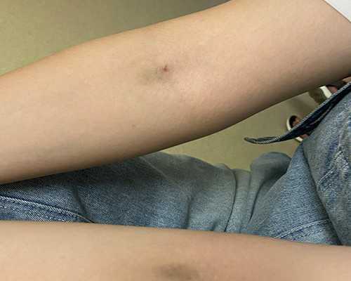 50岁借卵自怀_三院第三代试管收费,泰国第三代试管婴儿检查项目！_试管促排期