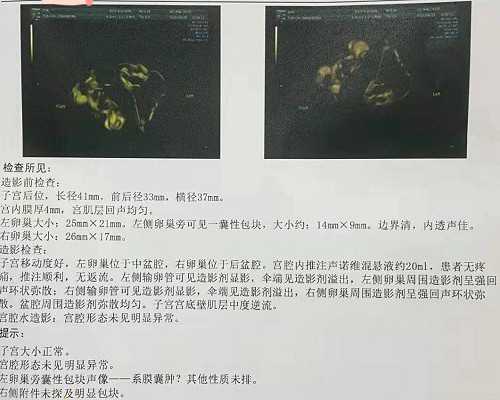 代怀孕机构价钱_代怀小孩哪家正规,兰州供卵医院可靠吗（北京供卵试管婴儿生