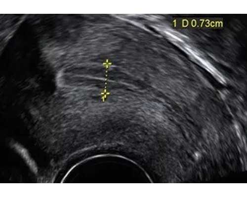 三代试管多少钱_aa69助孕,49岁做试管可以包男孩吗？_上海哪个医院有供卵-老公