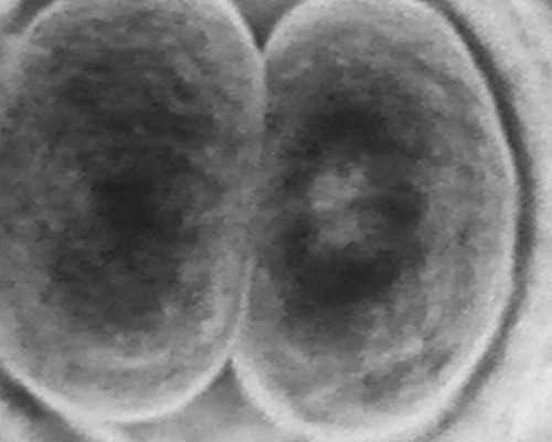 孕早期的健康食谱：莲子汤是否符合营养需求？